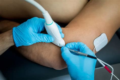 Fisioterapia Electrolisis Percutánea Terapéutica EPTE Qsana