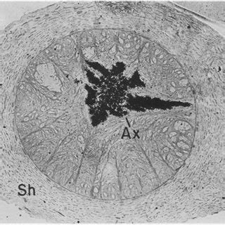 Light Microscope Autoradiograph Of A Cross Section Of The Right