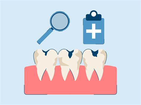 Rotten Teeth: Symptoms and Treatment