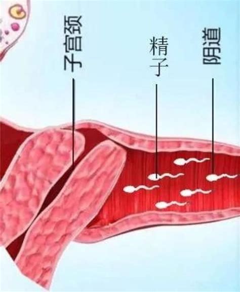 宫颈位置也会影响好孕（有图） 微医（挂号网）