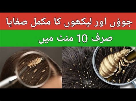 How To Remove Head Lice In Minute Sar Ki Juen Khatam Kane Ka