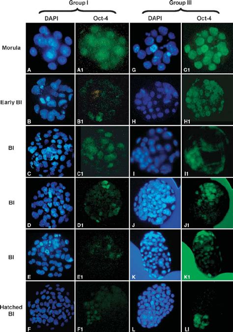 Dna And Oct Staining Patterns In Morula Blastocysts Derived From