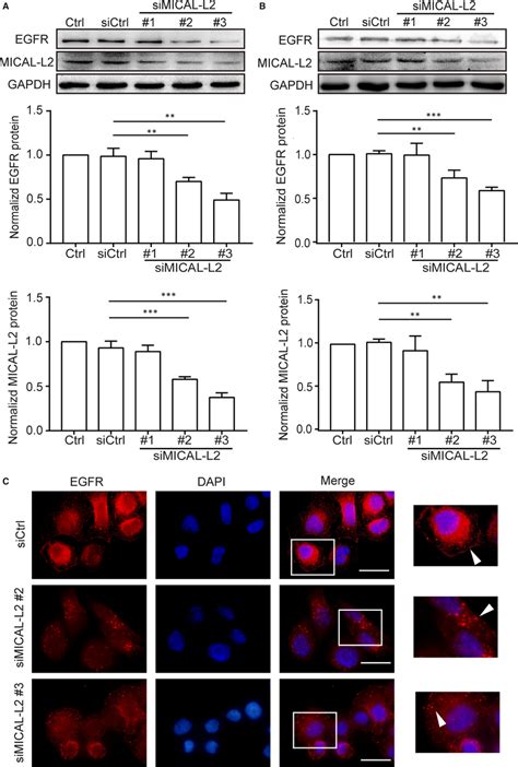 Depletion Of Micall Inhibits Egfr Expression In Gastric Cancer Cells