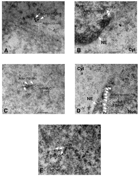 Electron Microscopy Of Immunogold Labeled Actin Ndh Ii And Hnrnp C In