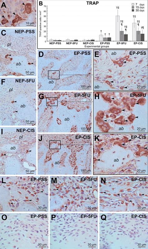 A Immunolabelling Pattern Of Trap In The Furcation Region Of The Lower