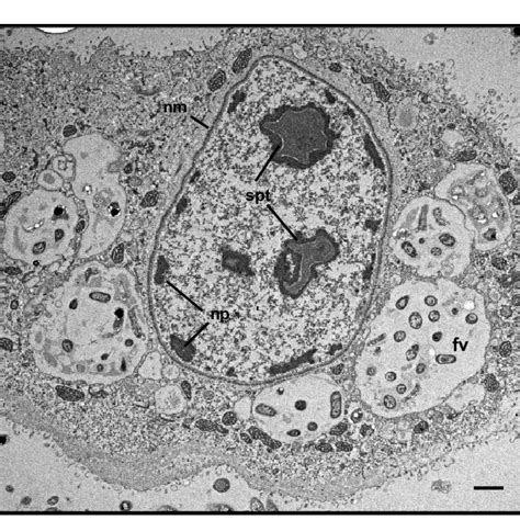 Another Mature Spore That Shows The Regular Peripheral Arrangement Of