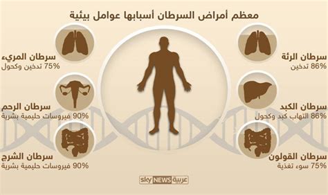 دراسة معظم أنواع الإصابات بالسرطان بسبب أنماط الحياة صحيفة الاقتصادية