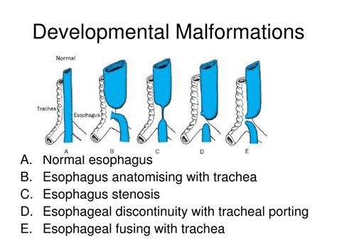 Ppt Physiology Of Mastication And Deglutition Chapter 8 Powerpoint