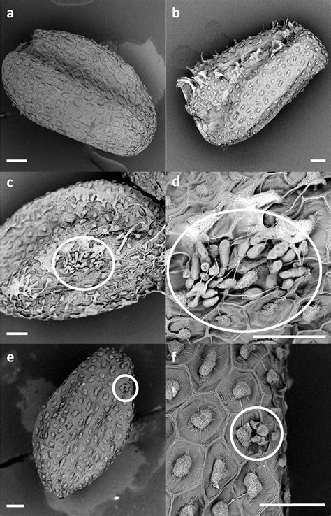 Scanning Electron Microscopy Observations Showing The Heterogeneity Of