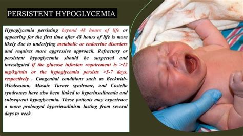 Management Of Neonatal Hypoglycemia Ppt Ppt