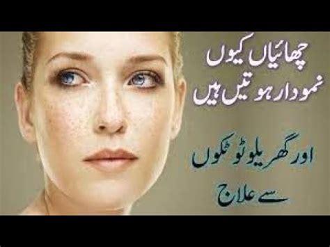 How To Whiten Your Skin Tone Fairness Cream Chahray Ki Chaiyon Ka Ilaj