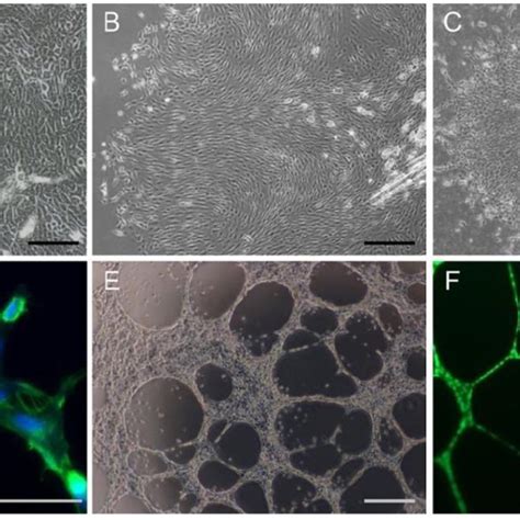 In Vitro Cell Growth Colony Formation And Tube Formation Of Cells