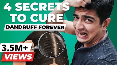 GOODBYE FOREVER, Dandruff – 4 SECRET Tips for Dandruff Removal ...