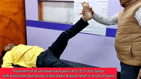 Treatment Of Acute Lower Back Pain L4 5 L5 S1 Disc Bulge With