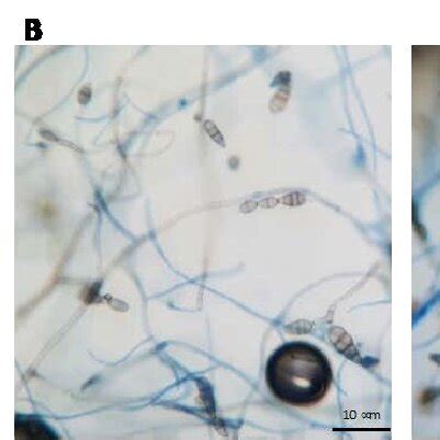 Morphological identification of Alternaria alternata. (A) A. alternata ...