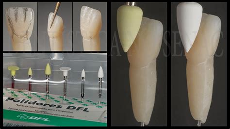 Dent Stica No Senac Dentes Anteriores T Cnicas De Estratifica O E