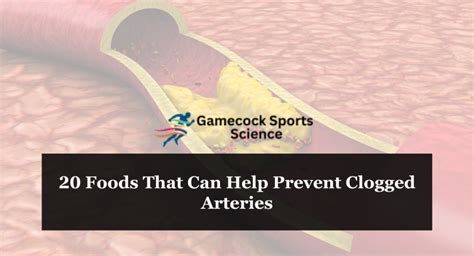 Foods That Can Help Prevent Clogged Arteries Gamecock Sports Science