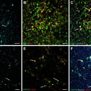 Immunolabeling Of Iqgap Nestin Gfap And F Actin In Human