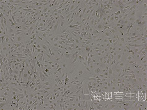 Hrmecs永生化人视网膜微血管内皮细胞 上海澳音生物科技有限公司