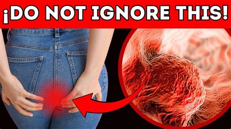 Colon Cancer Early Signs You Should Never Ignore Youtube