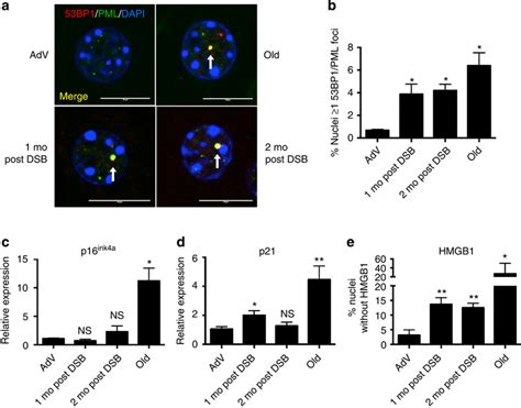 Dsbs Trigger Senescence In The Mouse Liver A Representative Images