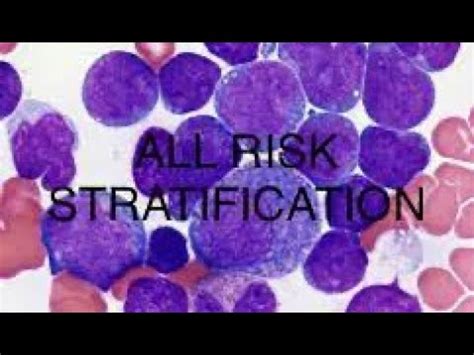 All Acute Lymphoblastic Leukemia Risk Stratification Dm Medical