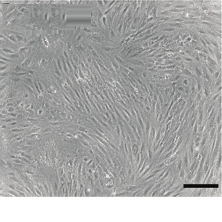 Representative Images Of Adipose Derived Stem Cells Before And After