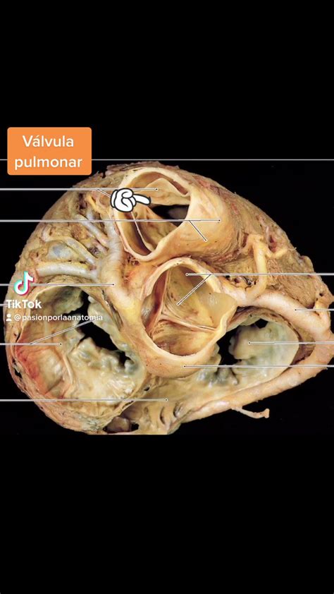 Pasión por la Anatomía on Twitter VálvulasCardiacas visión superior