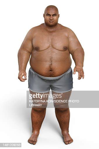 Obese Man Standing Illustration High-Res Vector Graphic - Getty Images