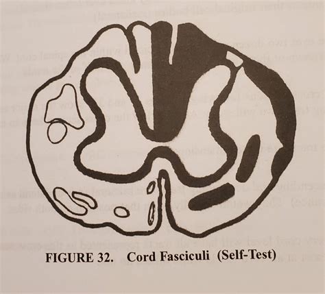 Neuroanatomy I Exam Ii Cord Fasciculi Diagram Quizlet