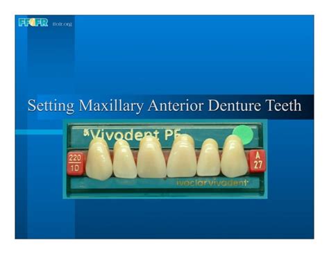 Complete Dentures 16occlusal Schemes Lingualized Occlusion Ppt