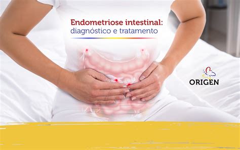 Endometriose intestinal diagnóstico e tratamento Clínica Origen