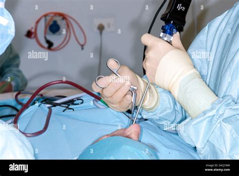 Nasal Polyp Surgery Surgeon Using Endoscopic Tools To Excise A Polyp