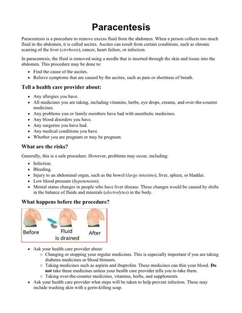 Paracentesis Paracentesis Is A Procedure To Remove Excess Fluid From