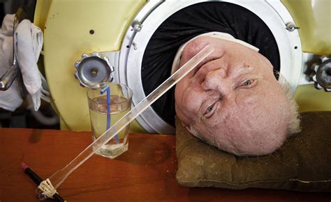 Dallas Lawyer Has Lived Most Of His Life In An Iron Lung