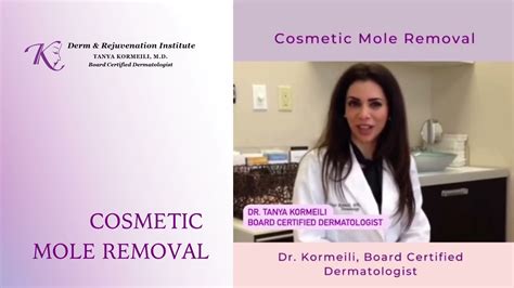 Cosmetic Mole Removal In Santa Monica Best Dermatologist In Santa