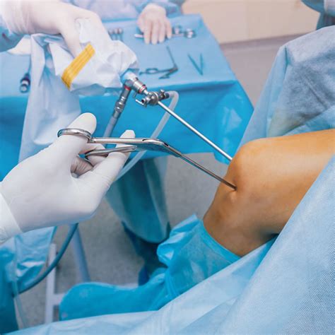 Knee Arthroscopy Cape Hip And Knee Cape Town