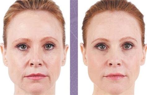 How About Face Yoga Workouts To Trim Excess Face Skin And Eliminate ...