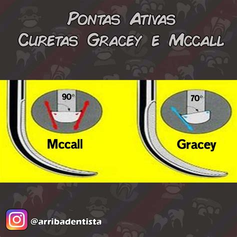 Diferenças Curetas Gracey e Mccall Instrumentais de Periodontia