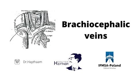 Brachiocephalic Vein Tributaries