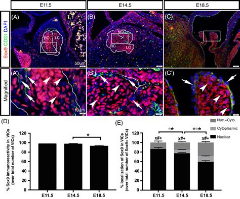 Dynamic Expression Profiles Of Sox In Embryonic Post Natal And Adult