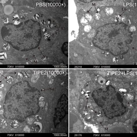 Tipe Overexpression Attenuates The Lung Ultrastructural Changes In