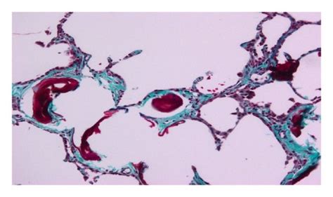 Histopathology A Hematoxylin And Eosin Stain ×10 B Trichrome