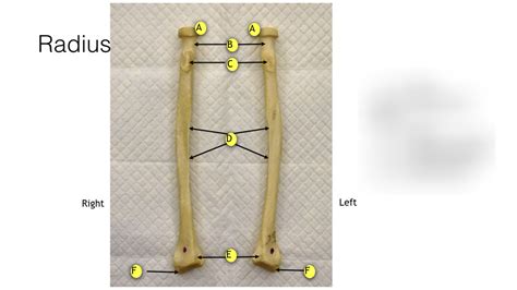 Radius Diagram Quizlet