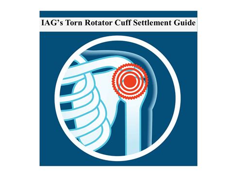 Torn Rotator Cuff Settlement Value 4 Sample Verdicts