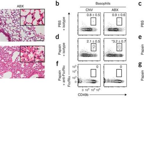 Exaggerated basophil-mediated allergic airway inflammation and TH2 cell ...