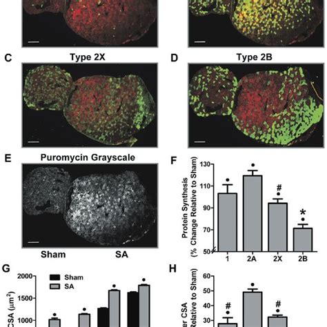 Food Deprivation Induces Fiber Type Dependent Changes In Protein