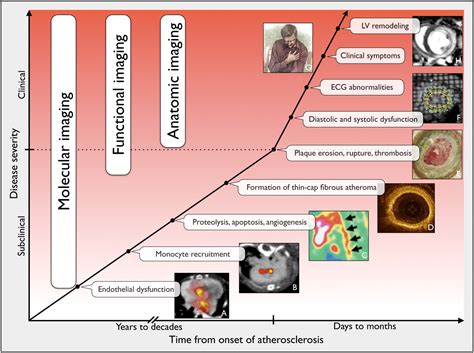 Cardiovascular Molecular Imaging The Road Ahead Journal Of Nuclear Medicine