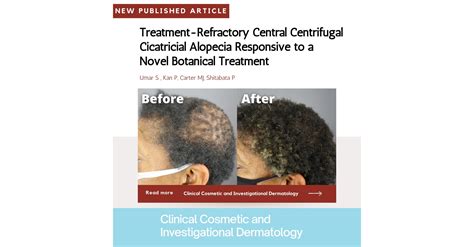 Treatment-Refractory Central Centrifugal Cicatricial Alopecia Responsive to a Novel Botanical ...