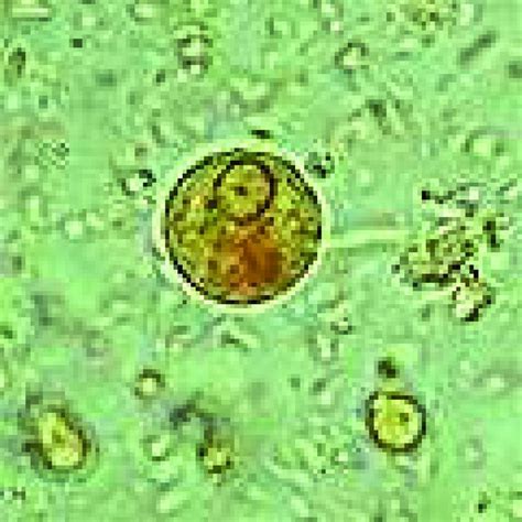 Entamoeba Coli Labeled